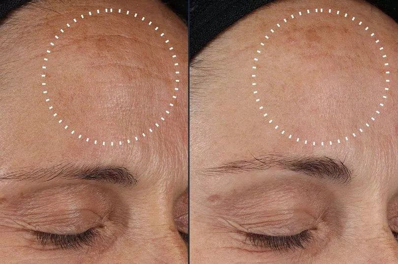 Seoul 1988 Multi-Repair Retinal Cream for Fine Lines & Dark Spots